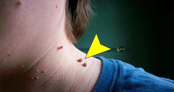 ET BENLERİNİ PATIR PATIR DÖKEN 5 DOĞAL TARİF Sağlık Faydalı Bilgiler