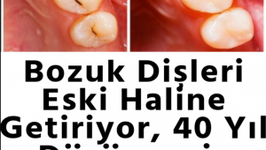 BOZUK DİŞLERİ ESKİ HALİNE GETİRİYOR, 40 YIL DÜŞÜNSENİZ AKLINIZA GELMEZ