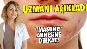 Cildinizi ‘maskne'ye karşı korumanız mümkün